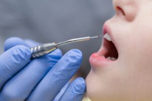 Laser dentistry Cary